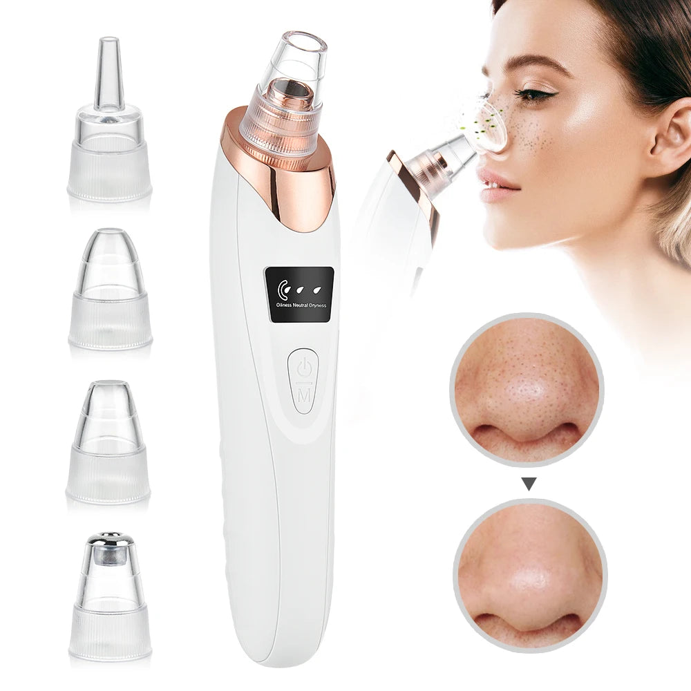 Extractor de Puntos Negros al Vacío- USB Rechargeable Facial Pore Cleaner Kit